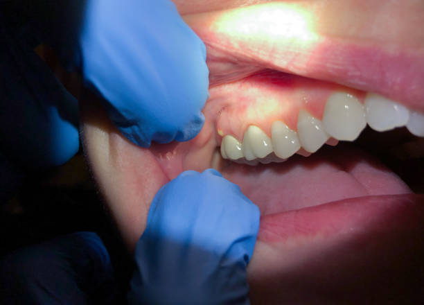 Best Same-Day Emergency Dentist in Kingston Estates, NJ