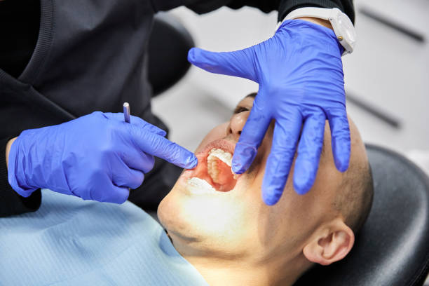 Best Emergency Wisdom Teeth Removal in Kingston Estates, NJ